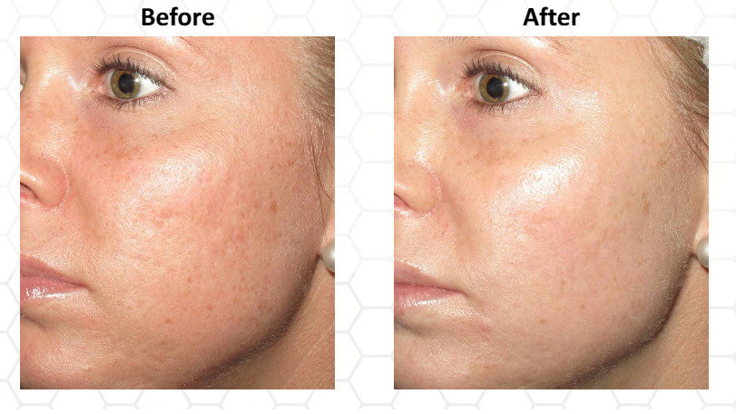 Vitamin C Serum 30% with Hyaluronic & Ferulic Acid - Anti-Aging Skin Care