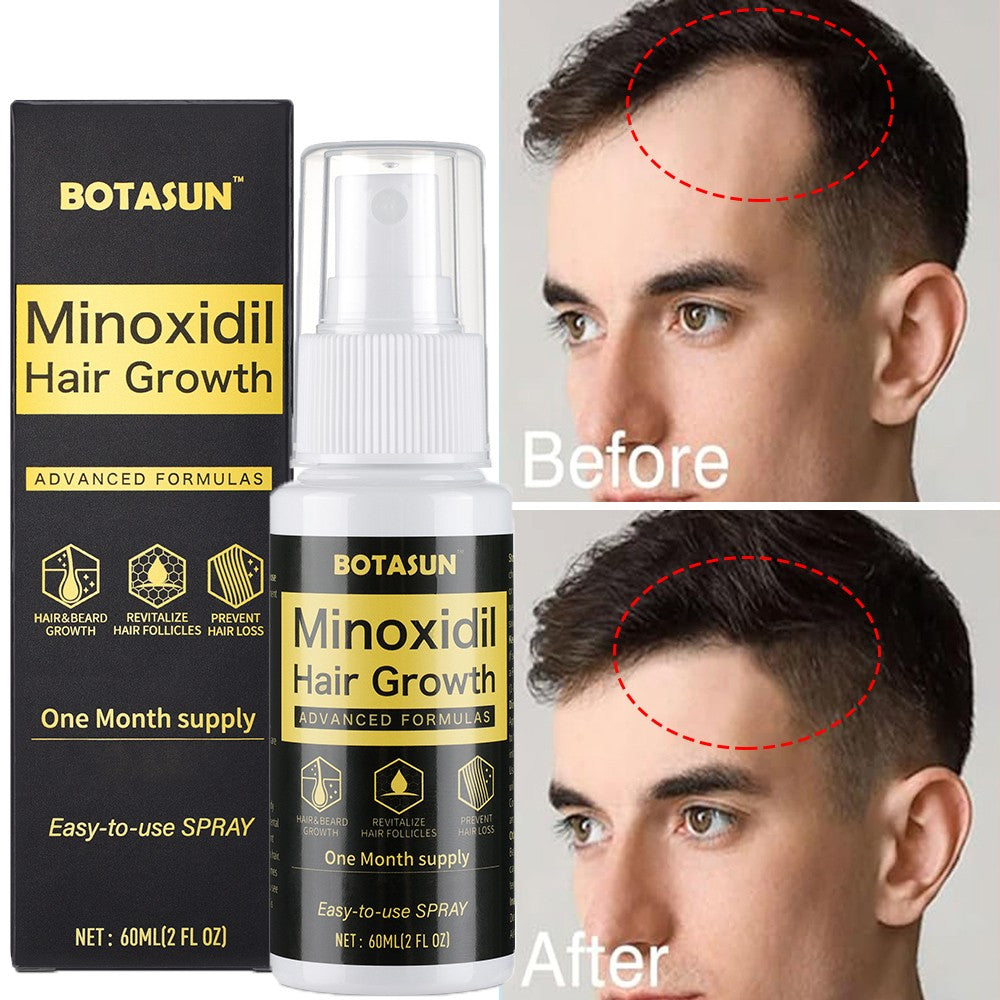 5% Minoxidil Hair Growth Spray for Men