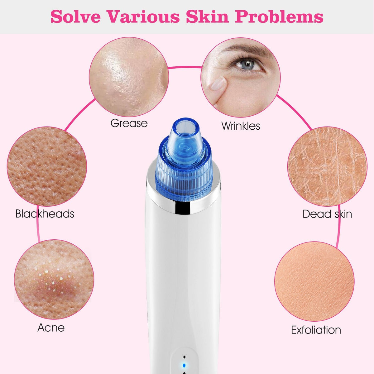 Electric Blackhead Remover Vacuum Pore Extractor with 4 Probes - USB Rechargeable
