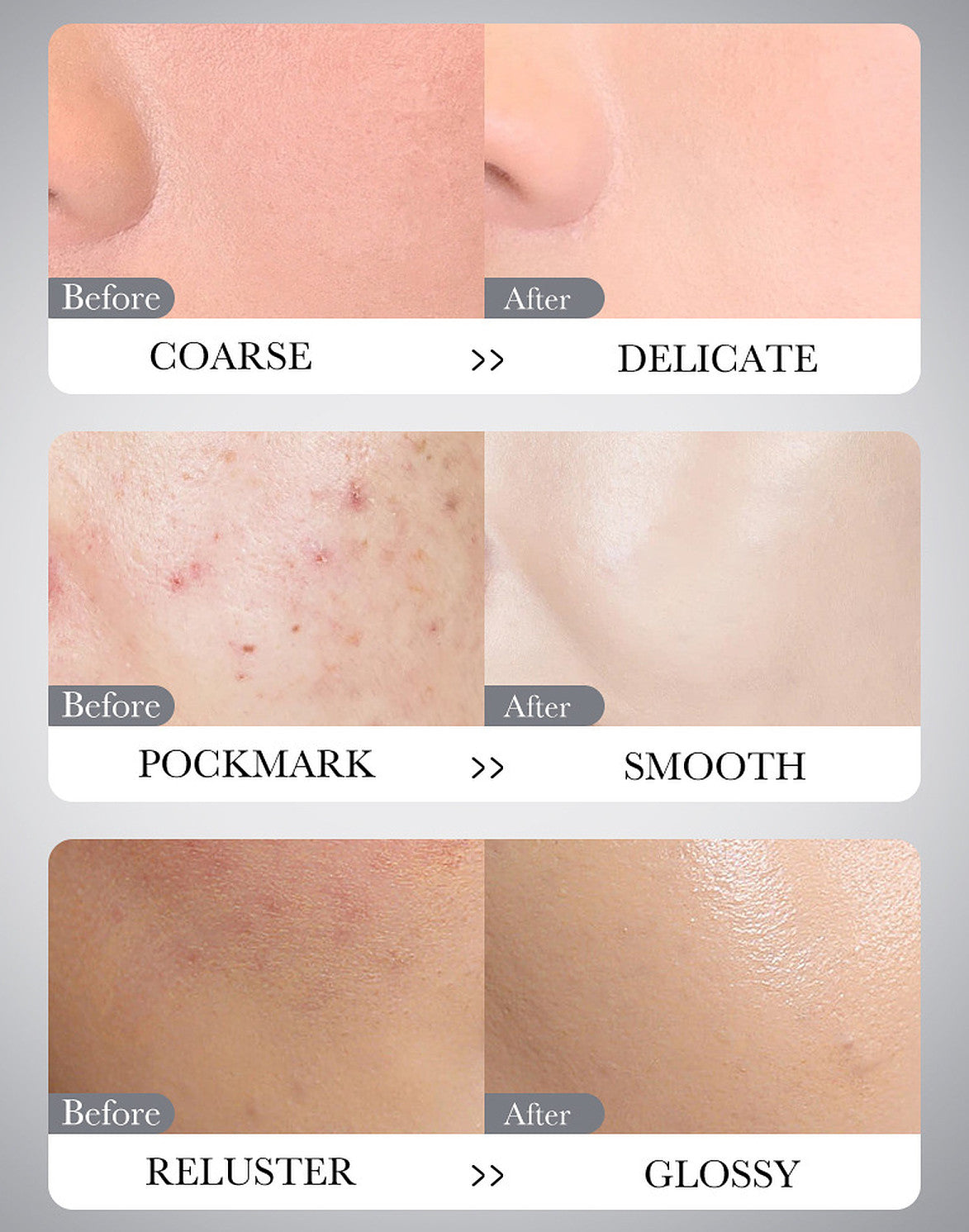 Dead Sea Mud Mask - Oil Control & Blackhead Removal, 8g x 10pcs