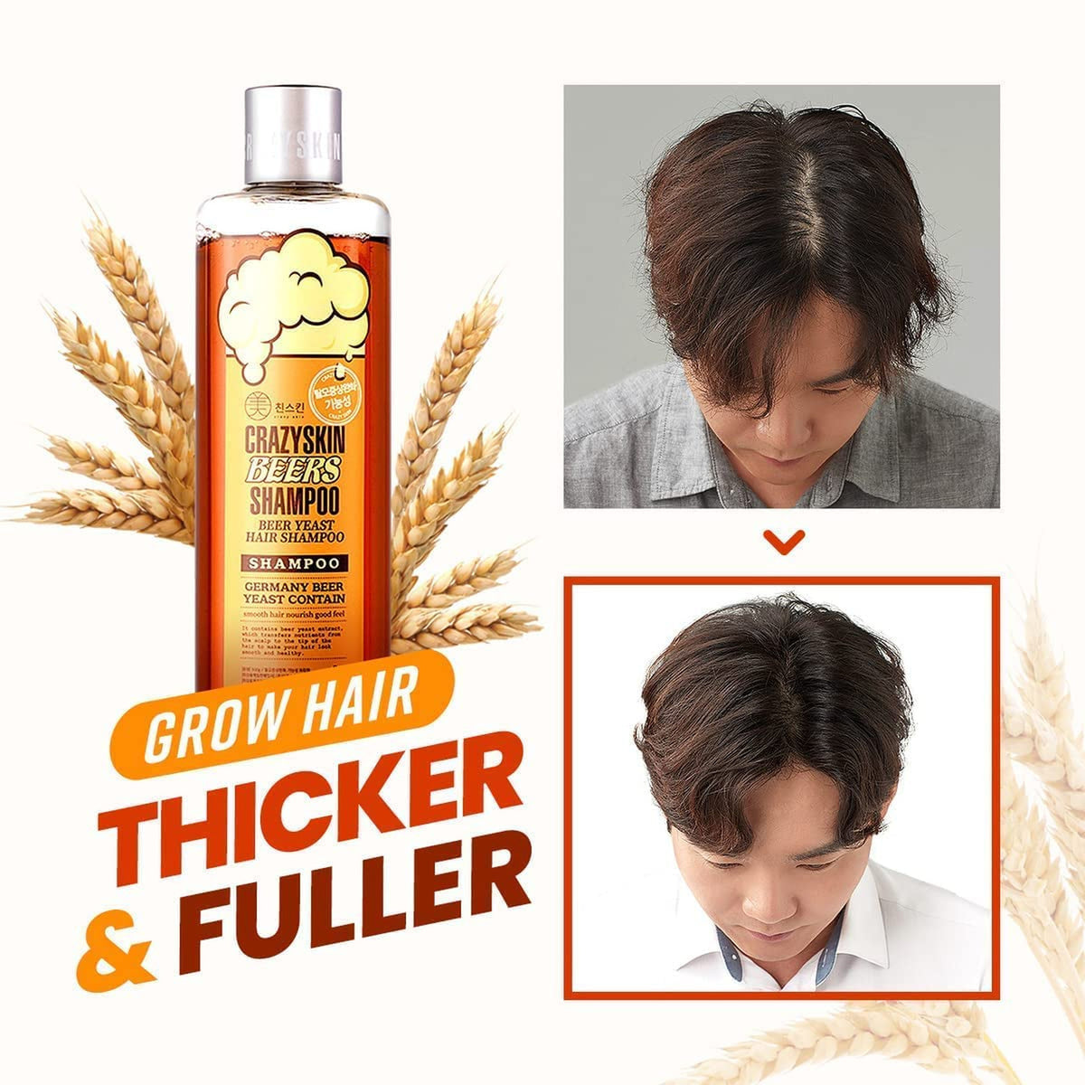 German Beers Yeast Biotin Shampoo for Hair Loss Prevention and