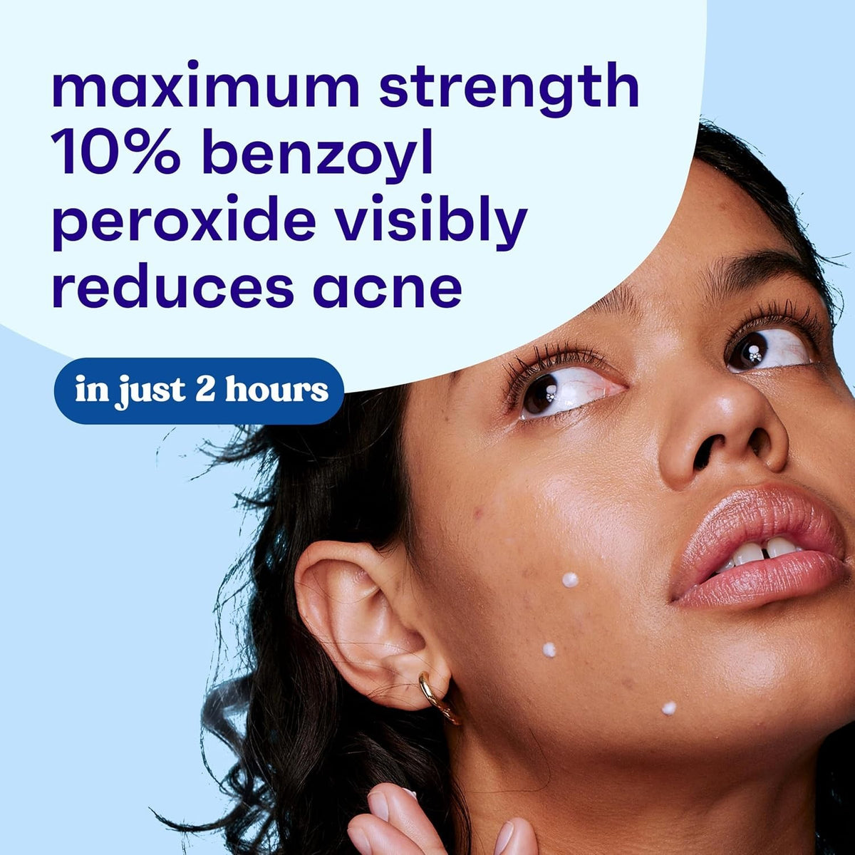 Maximum Strength Acne Spot Treatment Gel with 10% Benzoyl Peroxide - 1 oz, Cruelty-Free