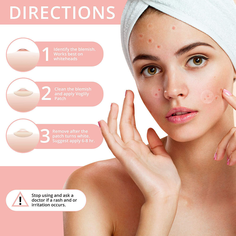 Hydrocolloid Acne Pimple Patches - Spot Treatment for Face & Scar Repair