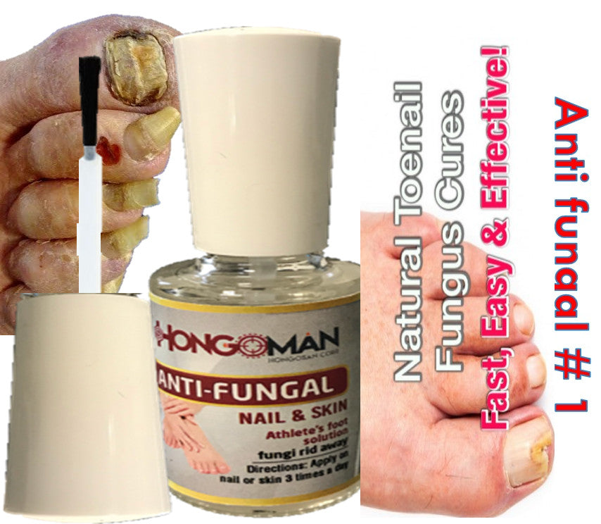 Natural Anti-Fungal Nail Support Kit for Toenails and Feet - 2oz Spray & Brush