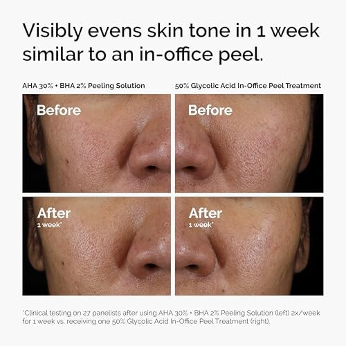 AHA 30% + BHA 2% Exfoliating Peel for Brightening Skin - Cruelty-Free