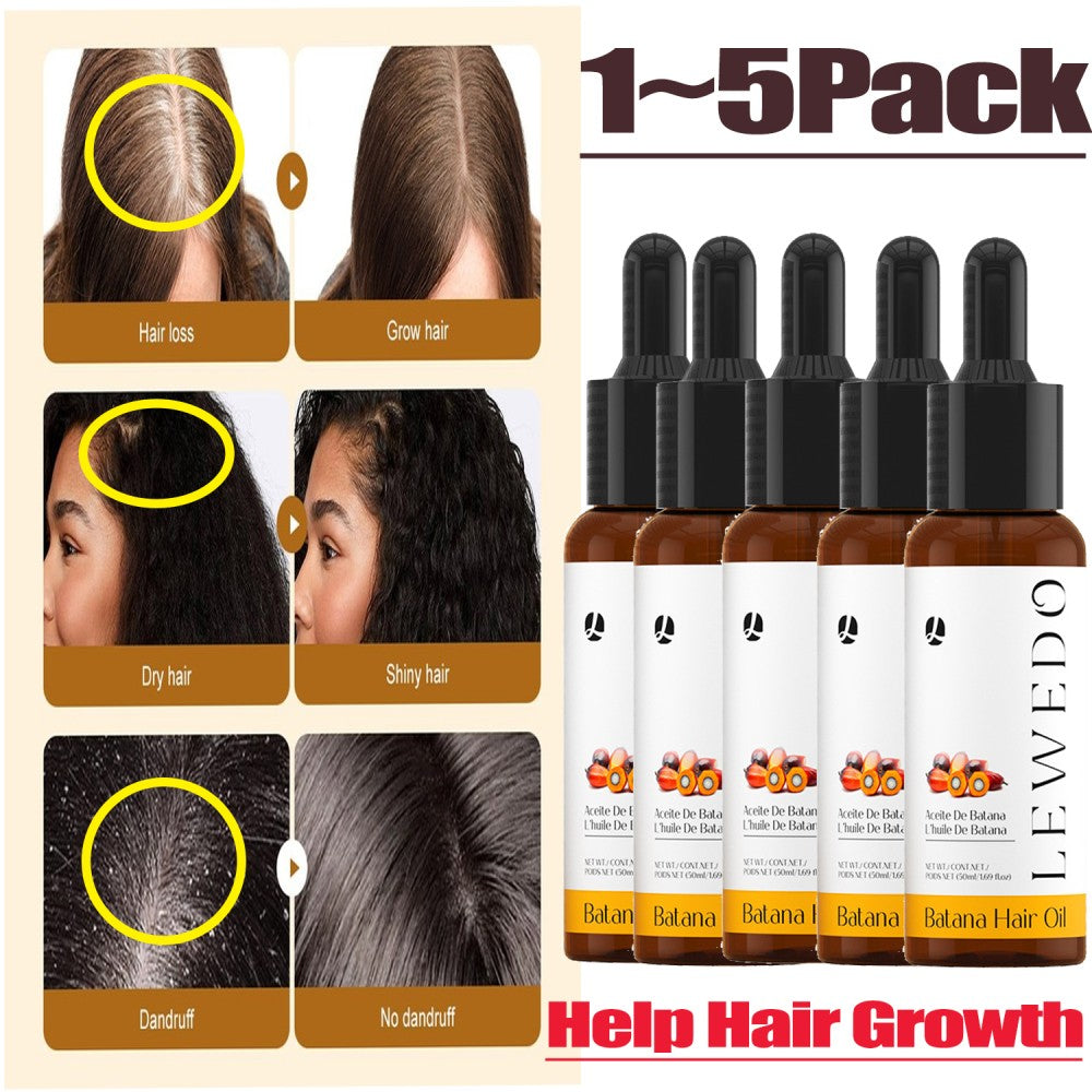 Herbal Hair Growth Shampoo Anti-Hair Loss Treatment