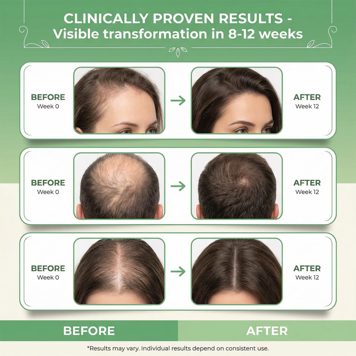 Rosemary & Rice Water Hair Growth Spray with Biotin & Caffeine