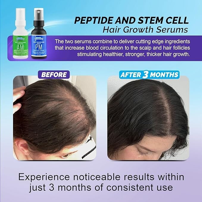 Multi-Peptide Hair Regrowth Serum for Men & Women