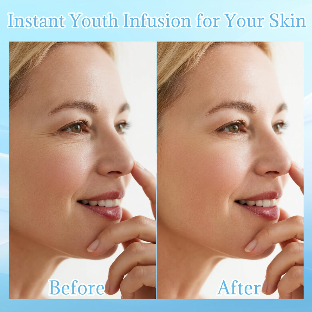 Micro Needling Face Kit with Serum Infusion System for Rejuvenation