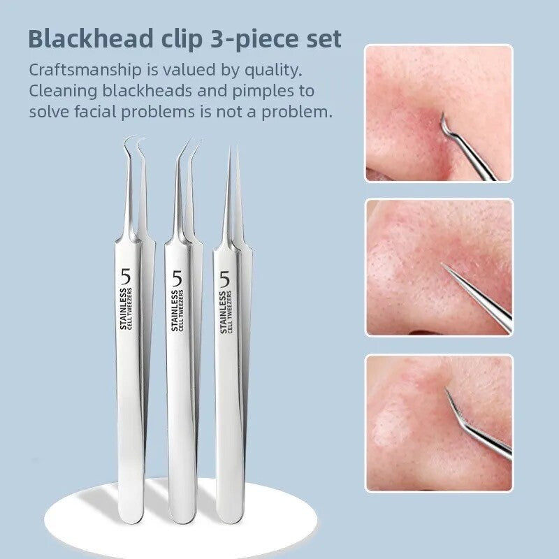 3PC Ultra-Fine Blackhead Remover Tweezer Set for Face Care - Salon Quality