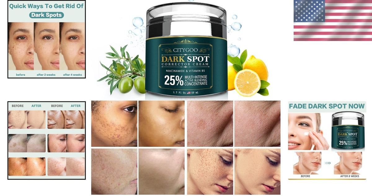 Dark Spot Remover Cream for All Skin Tones - Hydrating & Effective 1.7 FL OZ