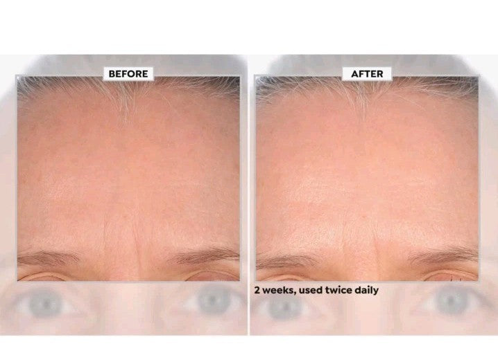 Black Rice Face Cream - Anti-Aging Moisturizer with Peptides & Antioxidants, 6.7 fl oz