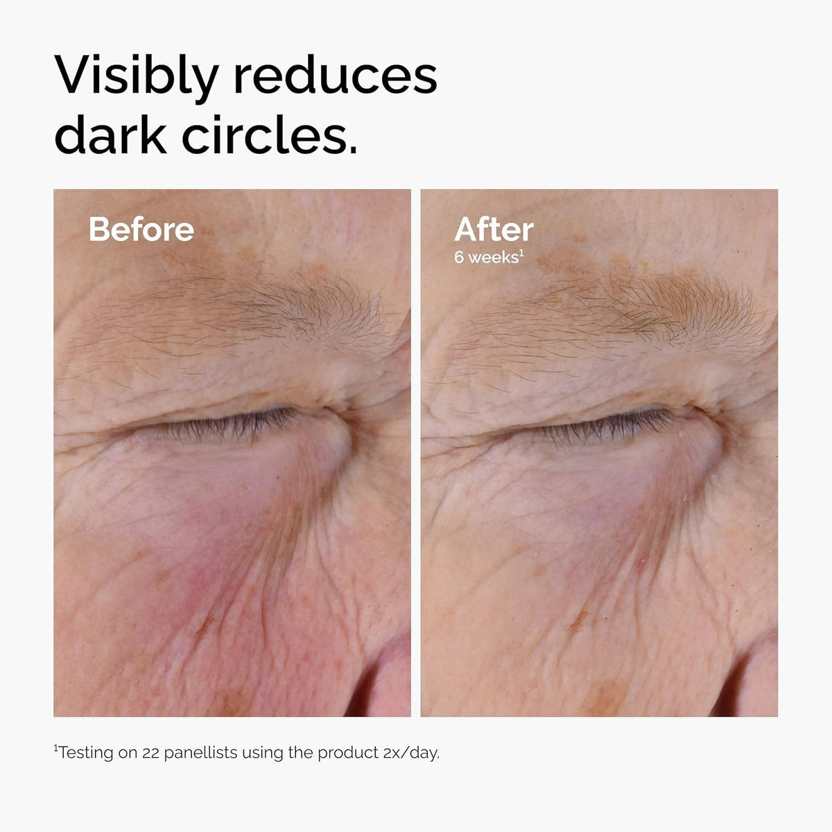 Eye Serum for Puffiness & Dark Circles - Caffeine & EGCG Solution