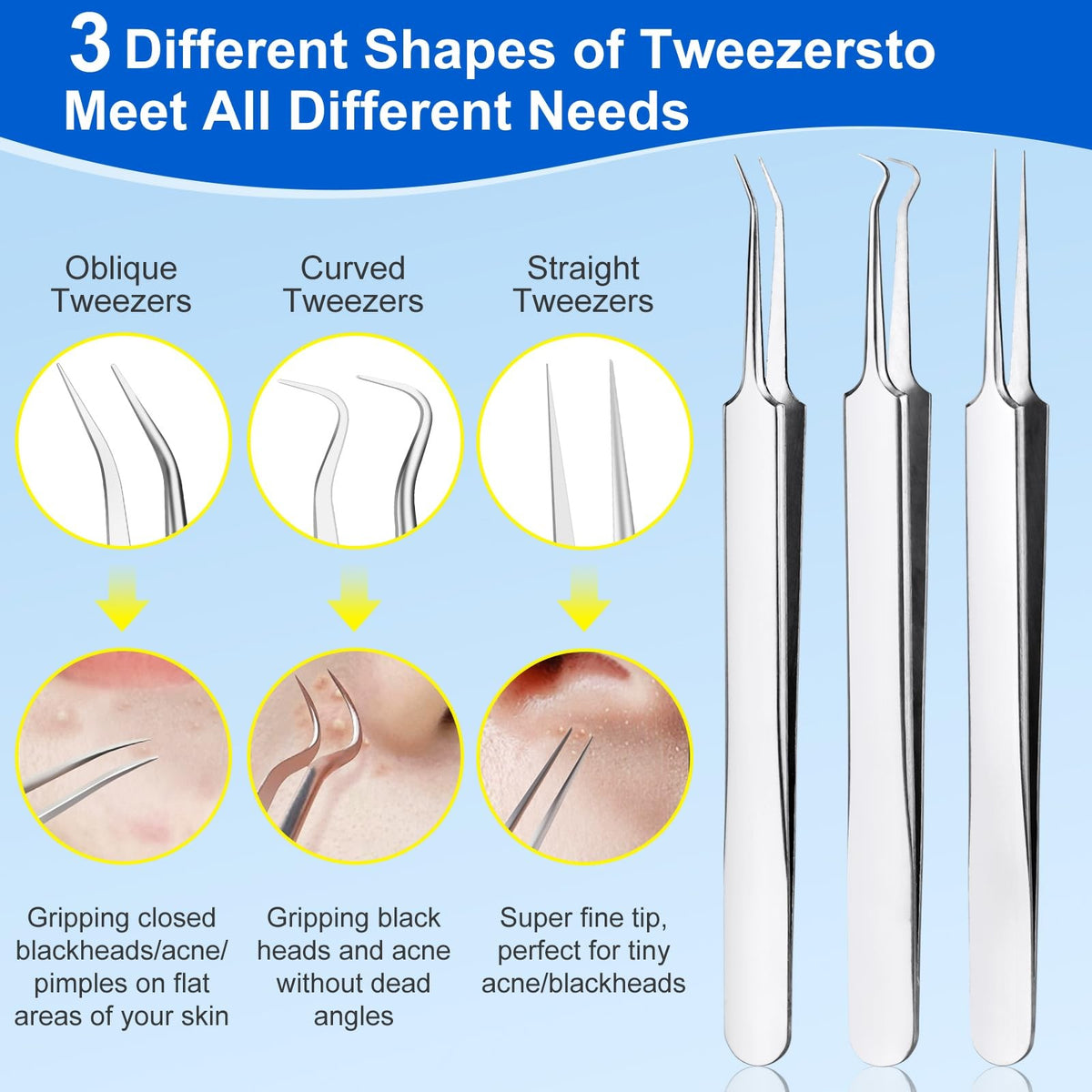Professional Blackhead Remover Tool Kit - 10 Pcs Skin Care Extractors
