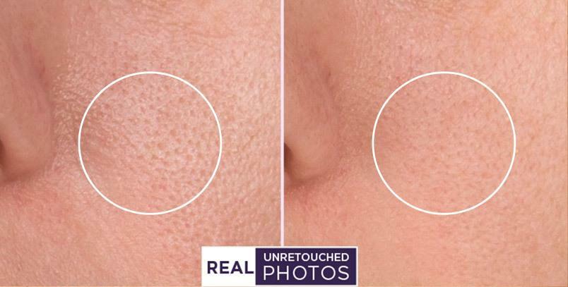 Hyaluronic Acid + Retinol Anti-Aging Serum 2-Pack