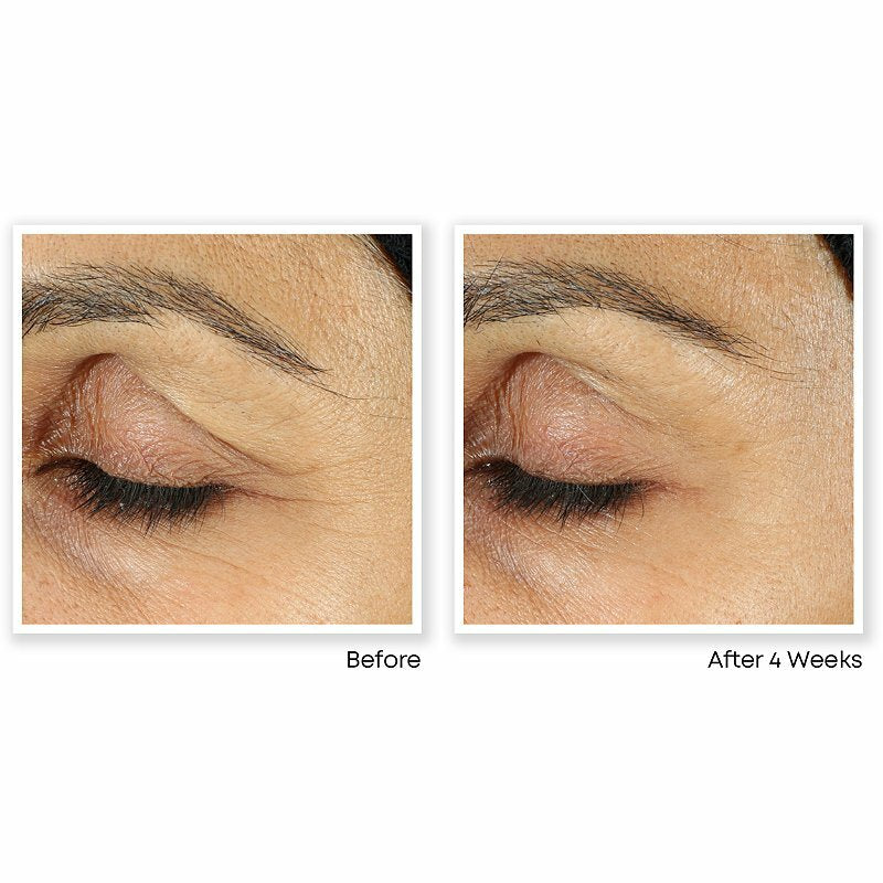 Peptide Eye Serum with Hyaluronic Acid & Vitamin C for Dark Circles & Wrinkles