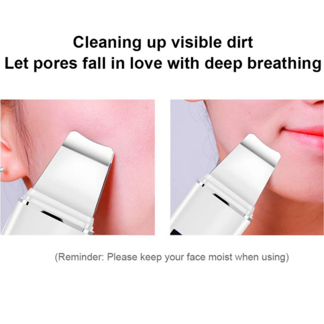 Ultrasonic Pore Cleaner for Blackhead Removal Facial Skin Scrubber