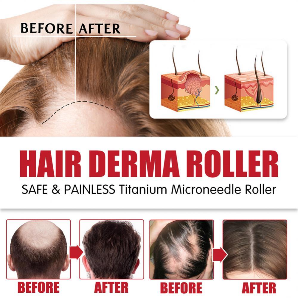 0.5mm Titanium Derma Roller for Hair, Beard & Skin Rejuvenation