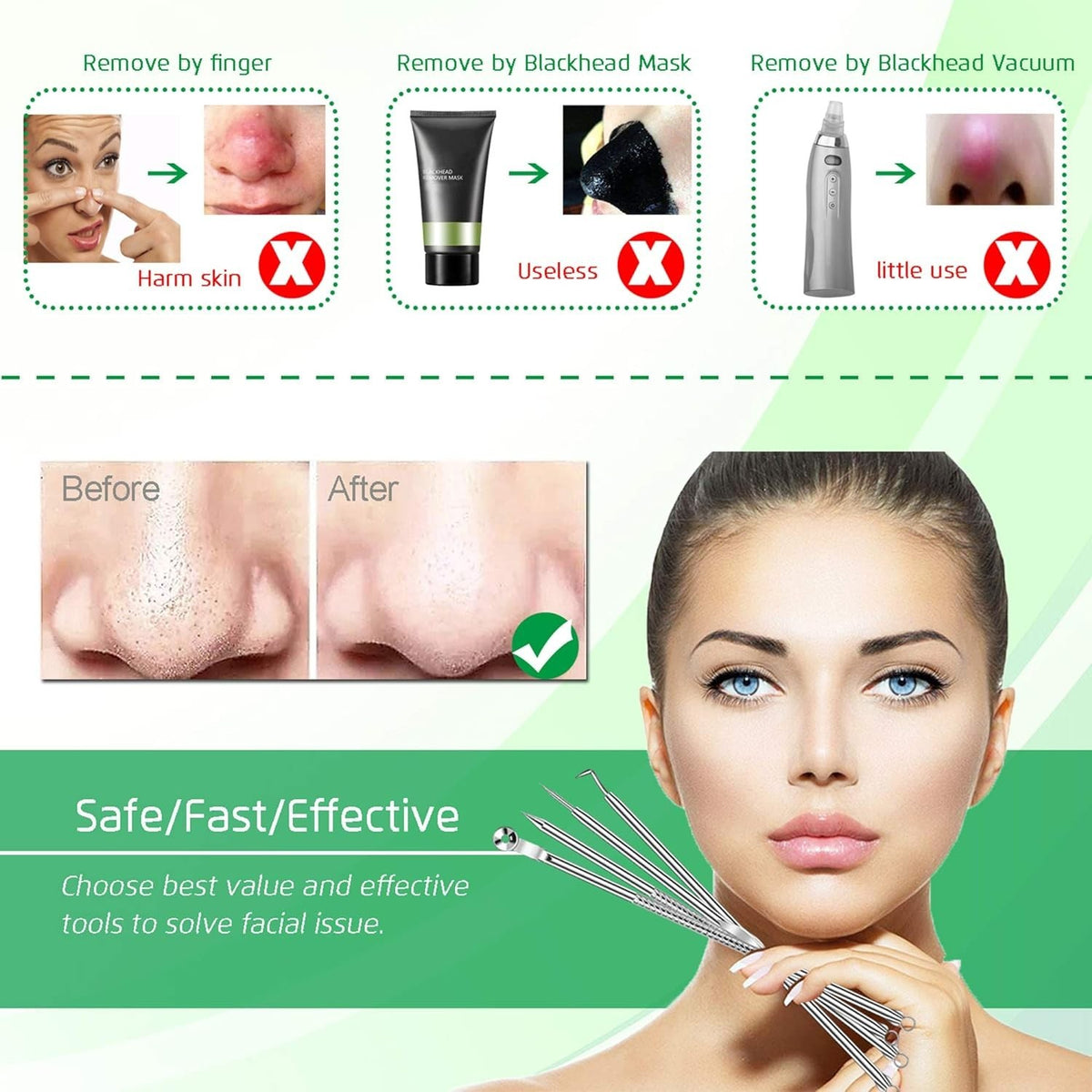 Comedone Extractor Set 5PCS - Blackhead Removal Tools for Facial Skin Care