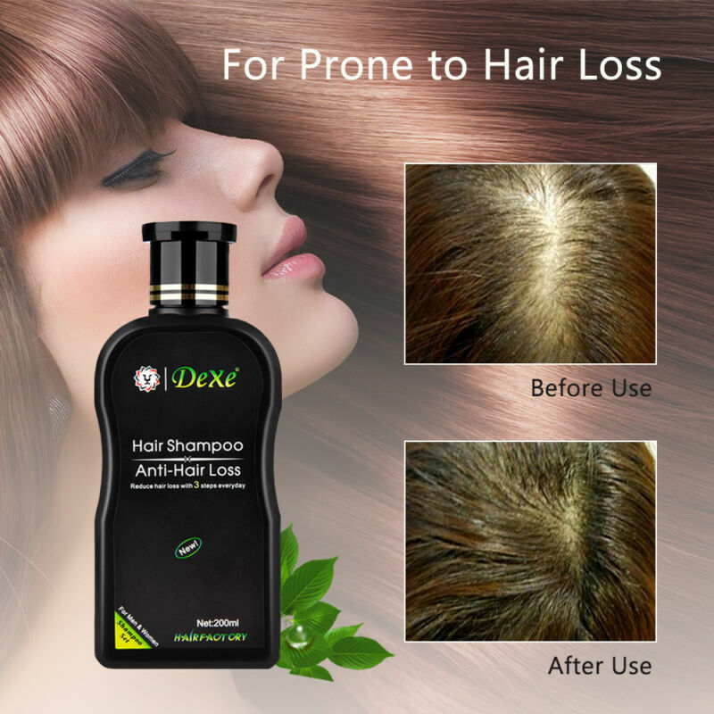 Anti-Hair Loss Shampoo, 200ml Herbal Growth Formula