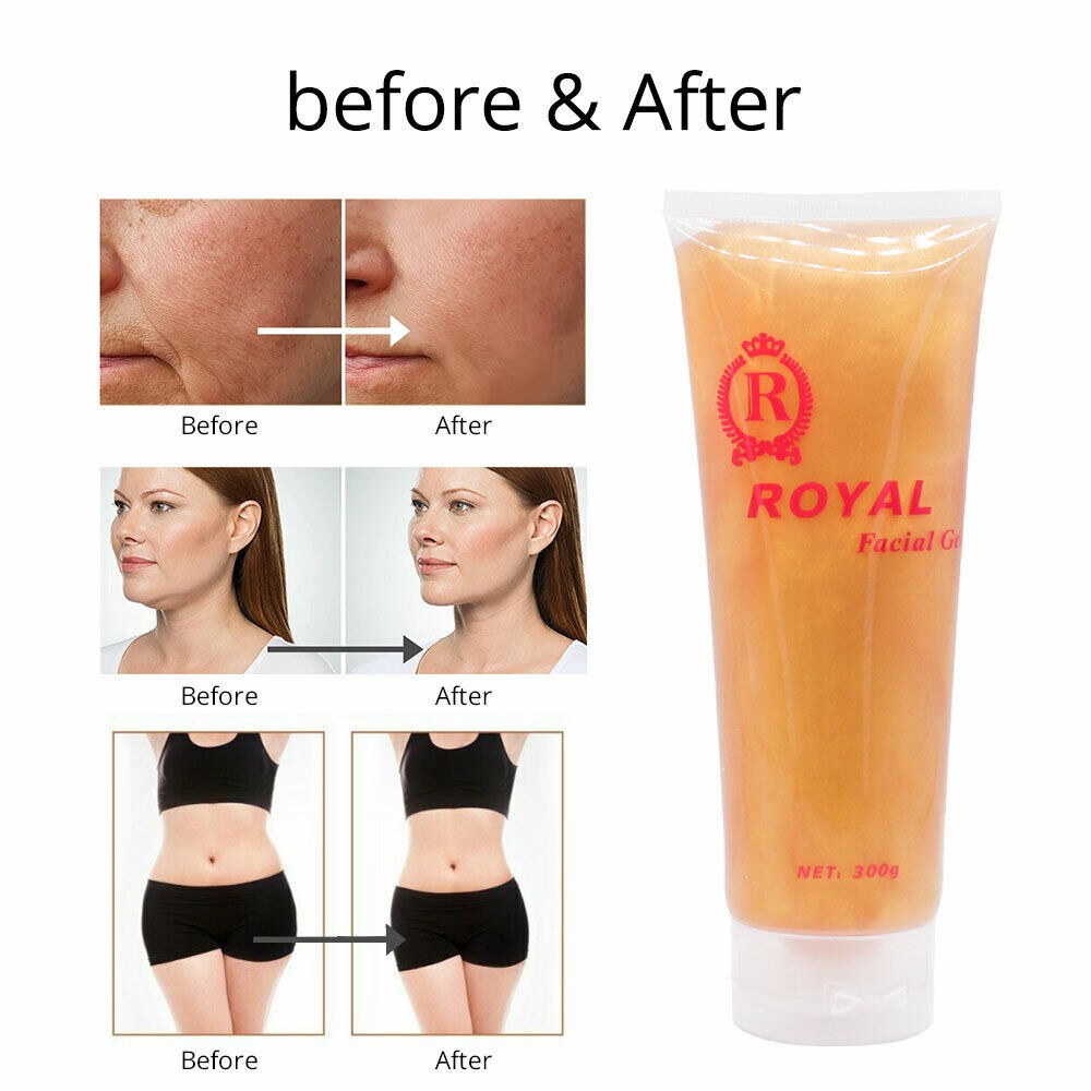 Body Slimming Gel for Cellulite Reduction & Skin Tightening 300g