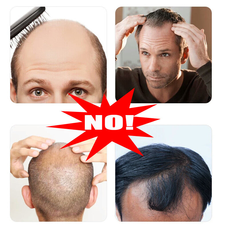 Men's Human Hair Toupee V Loop Hair Replacement System - Natural Look