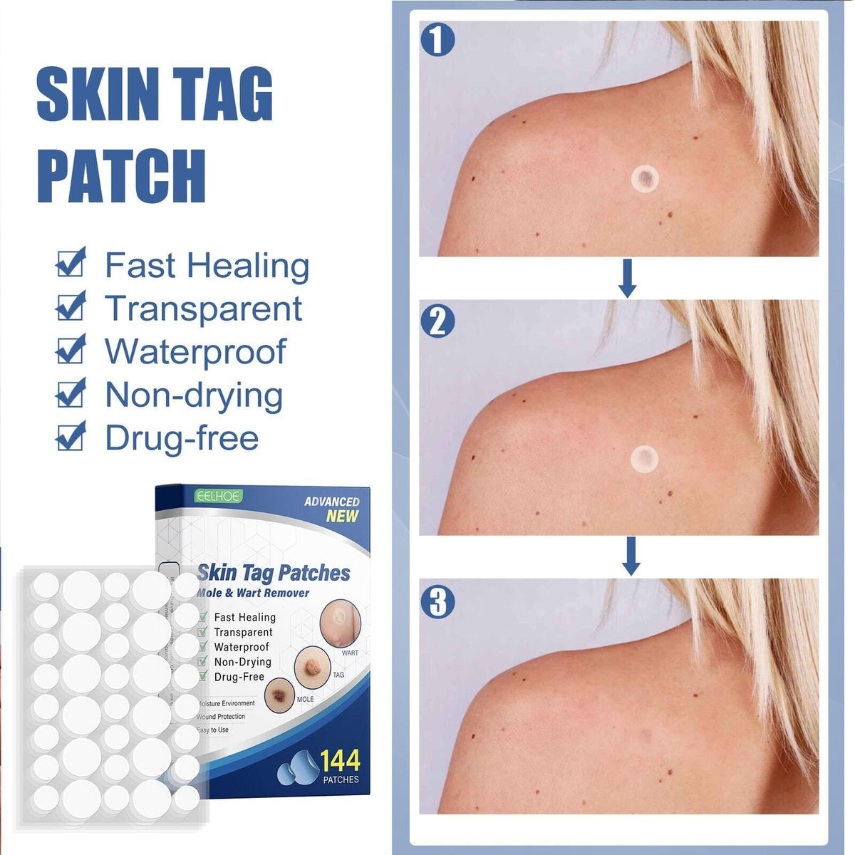 Skin Tag Remover Patches - 144 Effective Mole and Wart Removal Stickers