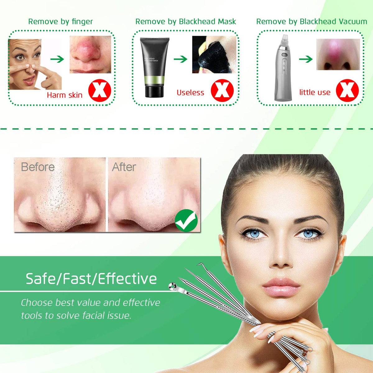 Blackhead Remover Comedone Extractor Set - 5PCS Skin Pore Tool Kit