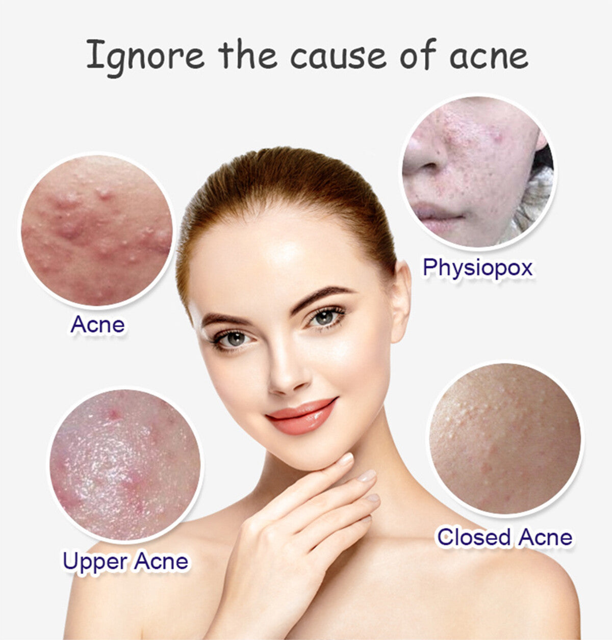 Anti-Acne Face Serum with Aloe Vera & Salicylic Acid for Skin Repair