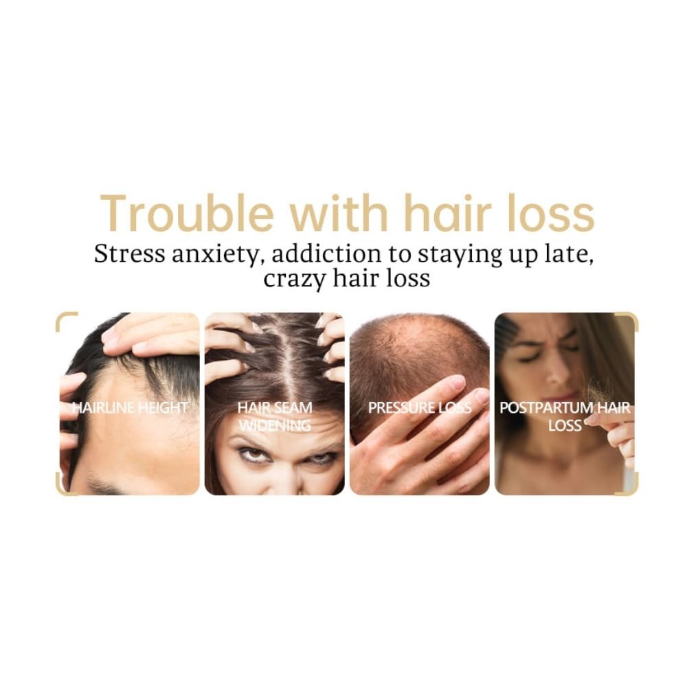Ginger Hair Loss Shampoo - Anti Hair Loss & Growth Formula 100g