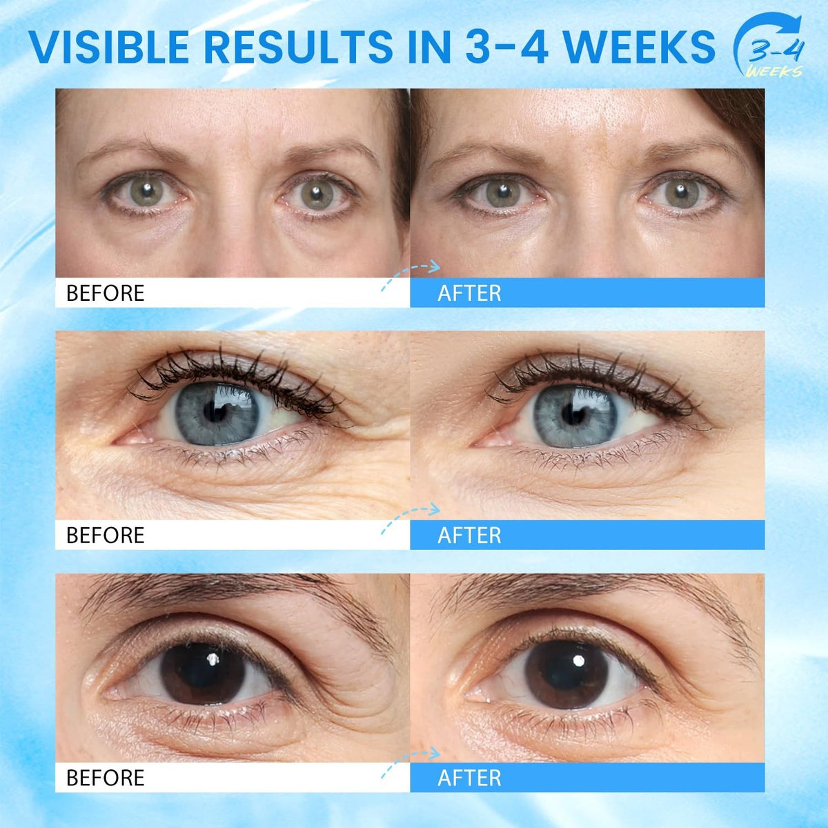Hydrating Caffeine Eye Balm for Anti-Aging & Brightening Under-Eyes
