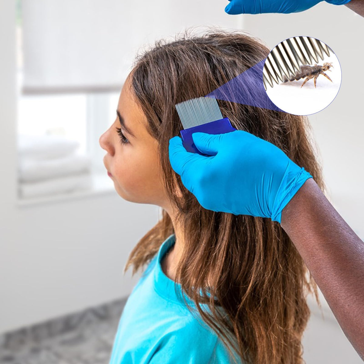 Lice Comb Set - Double Sided Fine Tooth Comb for Head & Pet Flea Removal - 8 Pack