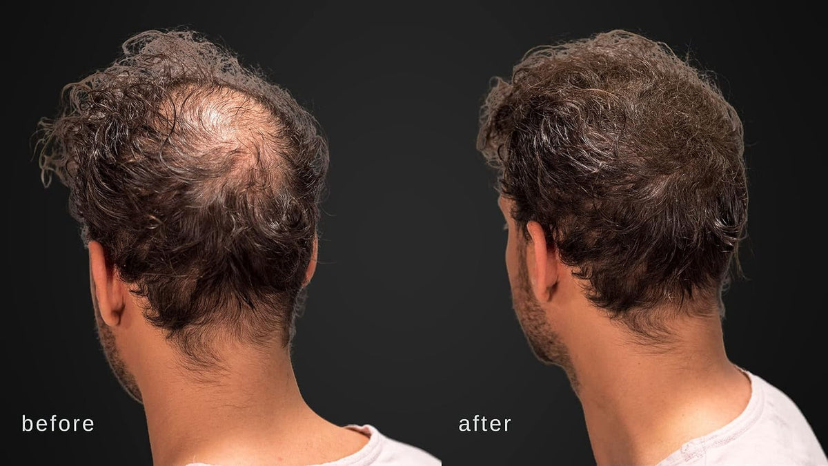 Hair Building Fibers, Volumizing Keratin Thinning Hair, Loss