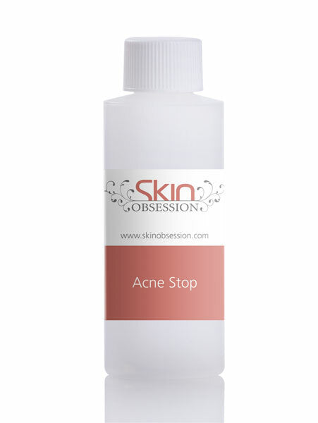 2 oz Acne Stop ~ Skin Obsession Reduces & Future Outbreaks!