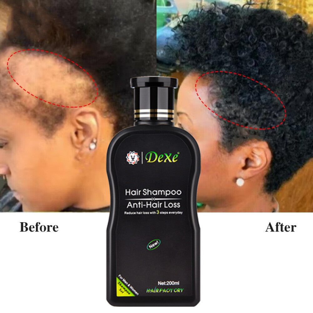 Anti-Hair Loss Shampoo for Hair Growth & Thickening - 200ml