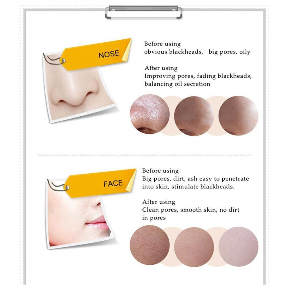 Charcoal Peel-Off Mask - Deep Cleansing Blackhead Remover