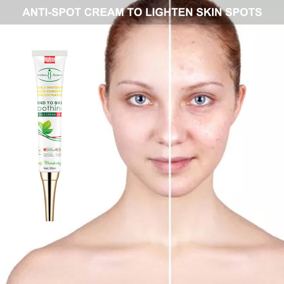 Whitening Freckle Cream for Melasma Acne Dark Spots 30ml - Skin Brightening Serum