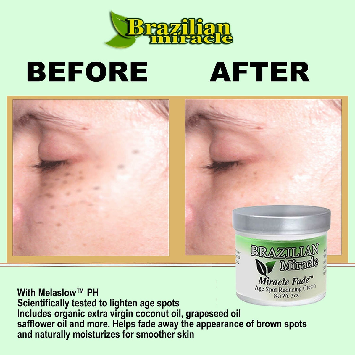 Natural Birthmark & Age Spot Lightening Cream - Botanical Formula, 1 Month Supply