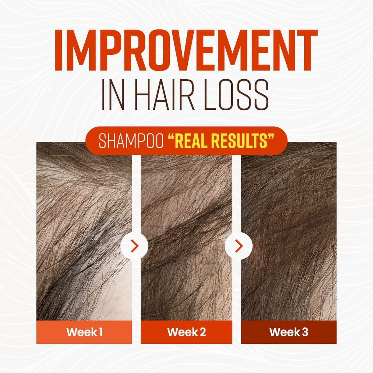 German Beers Yeast Biotin Shampoo for Hair Loss Prevention and
