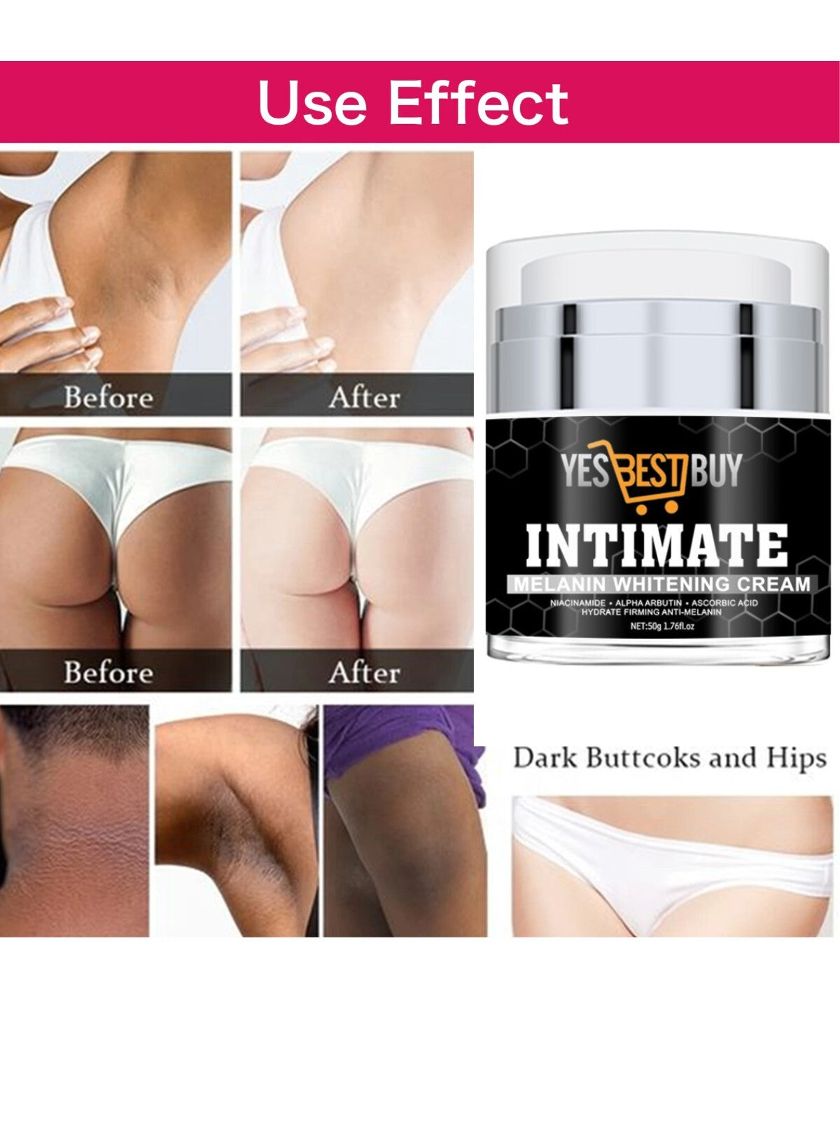 Skin Whitening Moisturizing Cream for Sensitive Areas - Underarm & Private Parts