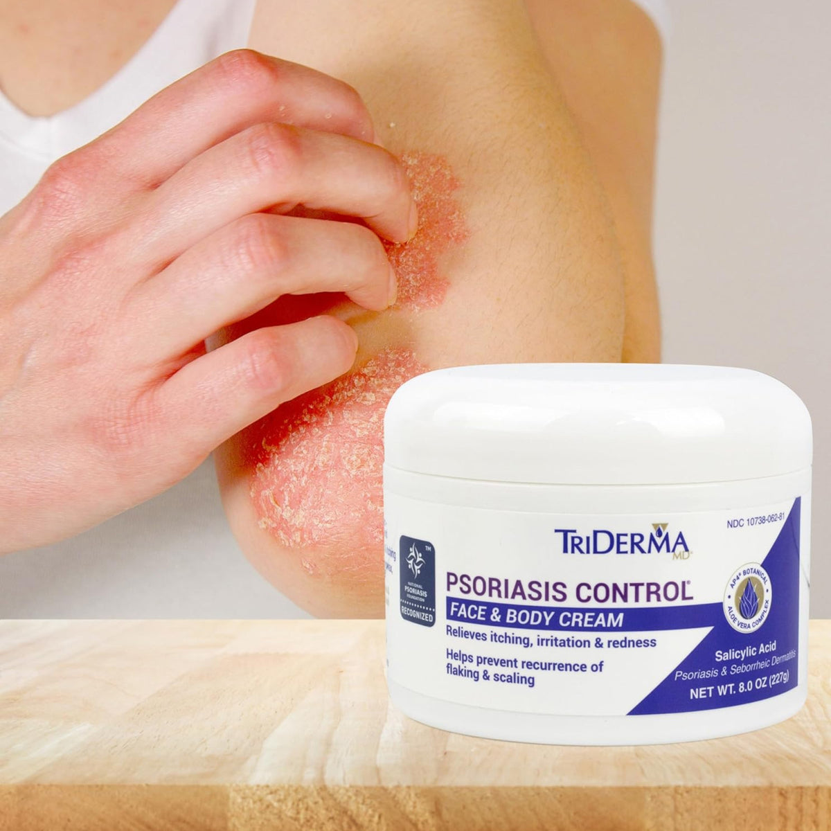 Psoriasis Control Cream 8 oz Maximum Strength Relief